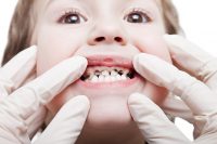 smile health dentisit teeth