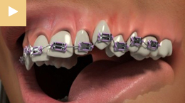 Orthodontics